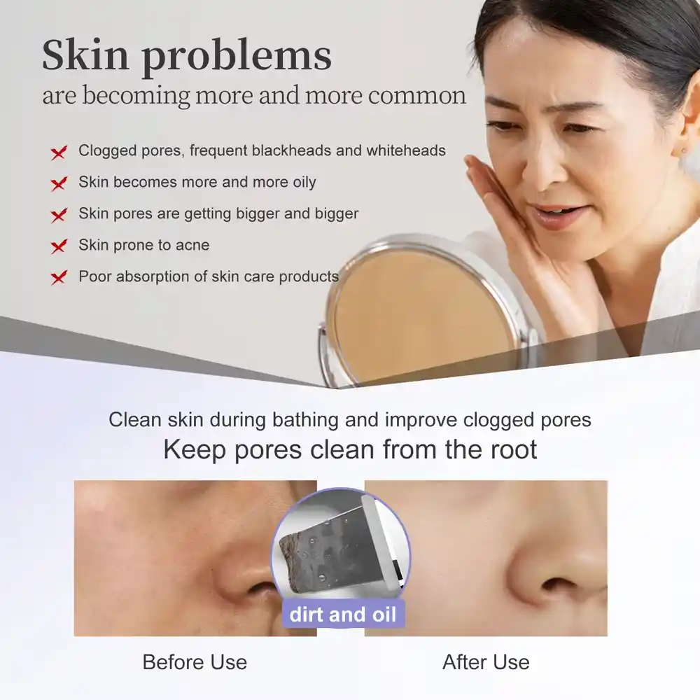 ANLAN Ultrasonic Skin Scrubber Peeling Facial Device